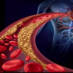 हाई कोलेस्ट्रॉल बन रहा युवाओं की बड़ी परेशानी, किचन की ये गलतियां बढ़ा रही हैं खतरा